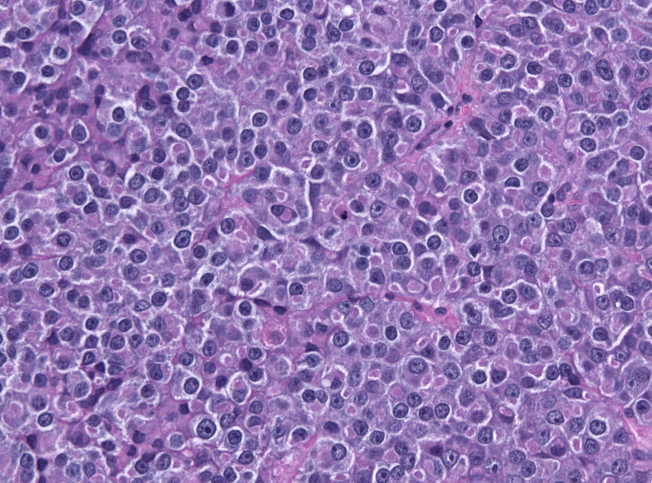 PRL HE histology