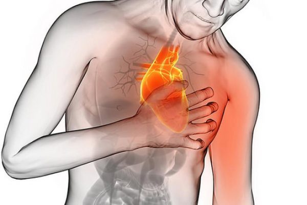 cardiov