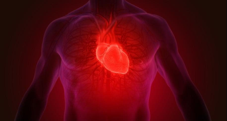 infarto miocardico acuto foto