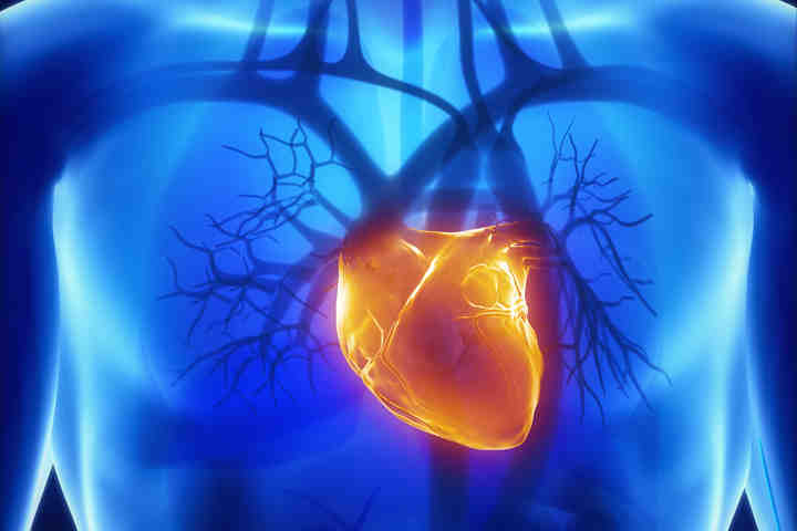 infarto miocardico aderenmza