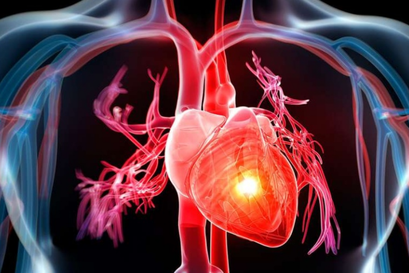 scompenso cardiaco 1